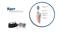 Original SYBRON KERRSoft-Core Obturators All sizes 20,25,30,35 (36 pcs per Pack)